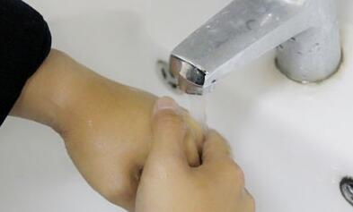 开水烫伤怎么办 开水烫伤后应注意这些