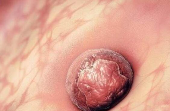 怀孕初期有点出血这是怎么回事 如何预防孕早期出血呢？