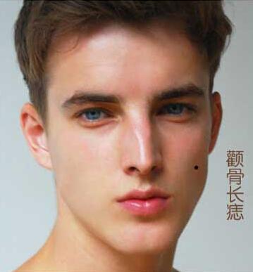 男人有痣气 就是好福气 什么地方有痣是天生好命男