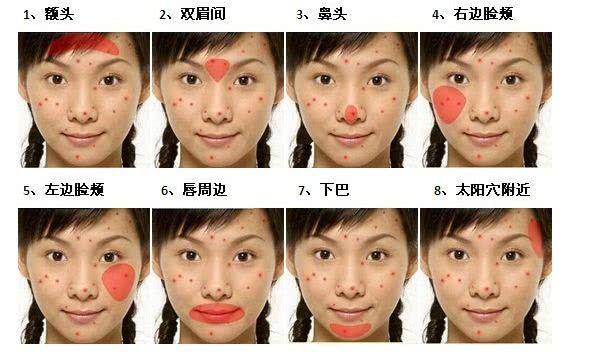 长痘痘位置详细图解 你脸上的痘痘是代表身体哪个地方出问题了？