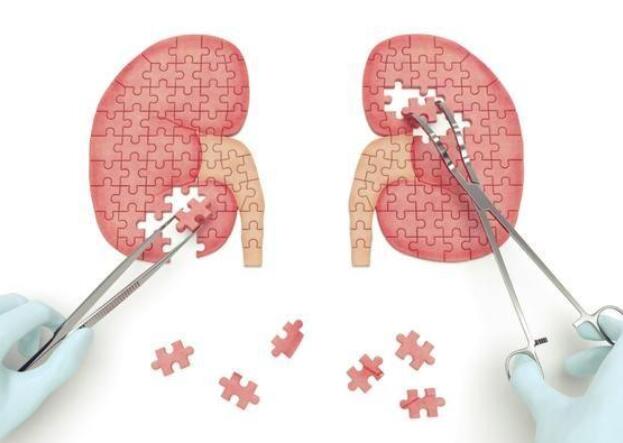 肾虚也有轻重之分 怎么判断肾虚是否严重