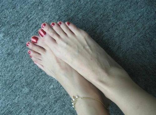 希腊脚是什么 希腊脚介绍