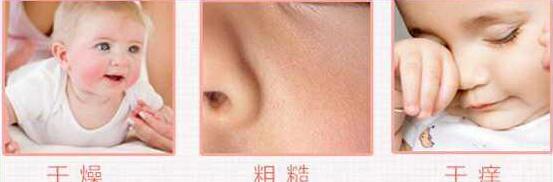 小孩皮肤干燥怎么办 宝宝护肤3大基本要点