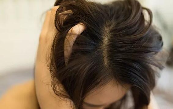 头发总爱出油是什么原因 该如何调理头发出油