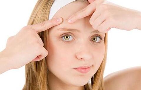 额头上长痘痘是什么原因?生活不规律导致额头上长痘痘