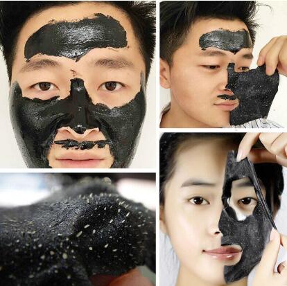 撕拉式去黑头危害有哪些 如何预防和去除黑头？