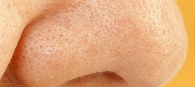 什么是黑头 去黑头鼻贴的危害 正确方法使用去黑头贴