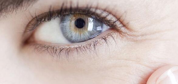 眼睛下有细纹怎么办 眼睛下是干纹还是细纹