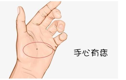 四种吉痣 这几处长痣的人此生非富即贵
