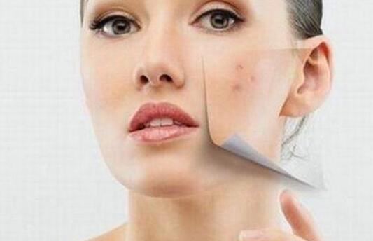 脸上痘痘红肿很硬很痛怎么办?千万不可以做这几件事