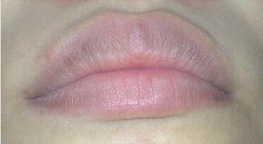 嘴唇发紫是不是有什么疾病呢?还是预兆着哪个身体器官出现了问题?