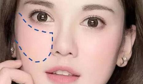 腮红怎么打好看 不同脸型的腮红怎么打