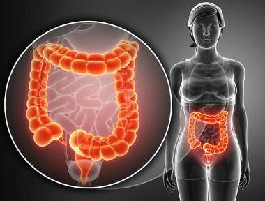 便秘容易引起结肠癌或乳腺癌，2个简单办法，让你和便秘无缘！