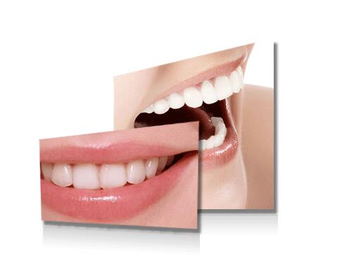 牙齿美白的简单小窍门 使用除牙垢、烟渍的小窍门