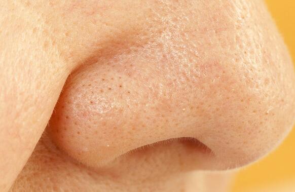 怎么用粉刺针去黑头?粉刺针使用时注意事项