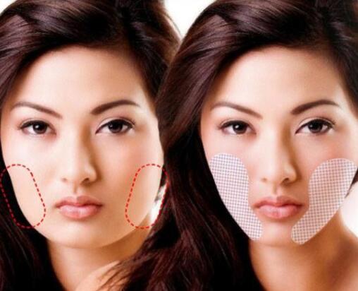 韩国瘦脸贴有效果吗？ 是否能用别的东西替代呢？