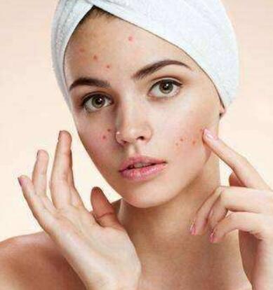 长痘痘用手抠了会留疤吗 长痘痘用什么护肤品好