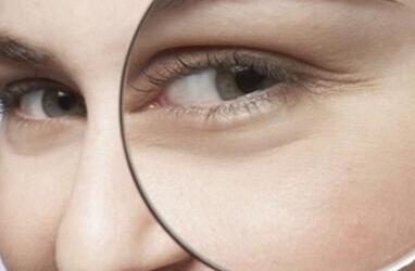 鱼尾纹怎么办？祛除鱼尾纹的5种方法