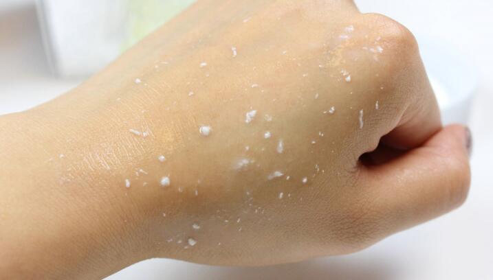 角质的作用是什么？哪些情况千万不能去角质