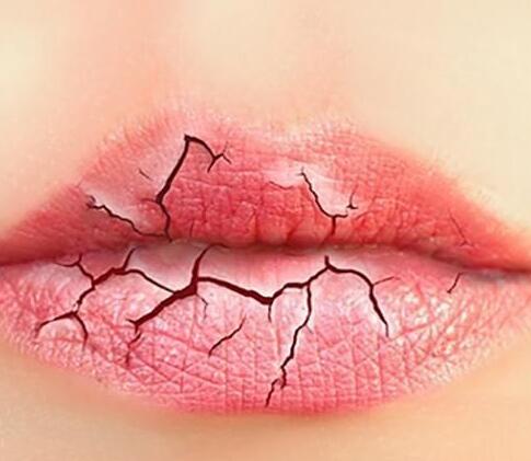 冬天嘴唇容易脱皮要怎么缓解？首先要改掉不良的习惯