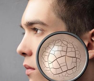 冬天皮肤会非常干燥粗糙 全身各处皮肤干燥的应对方法