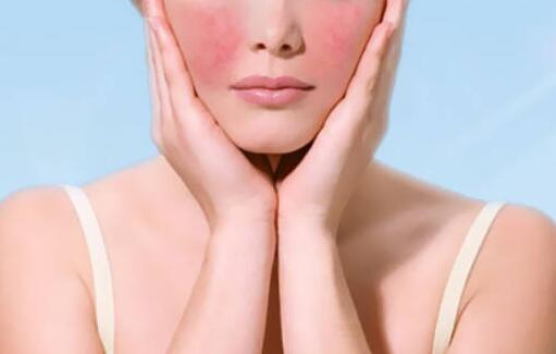 孕妇额头上长痘痘是什么原因呢? 不仅影响美观 还影响心情