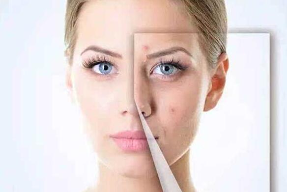 长痘痘都是因为饮食上的原因，常吃哪些食物会长痘痘呢？