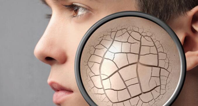 皮肤干燥起皮怎么办？脸干燥起皮生活小妙招