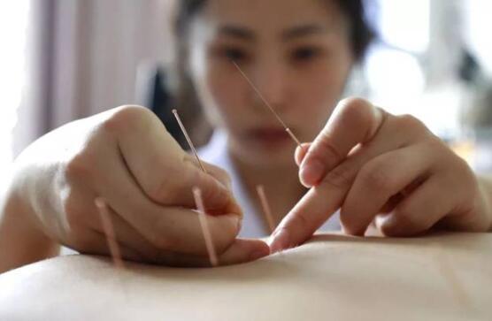 针灸有什么要注意的 针灸的功效与作用