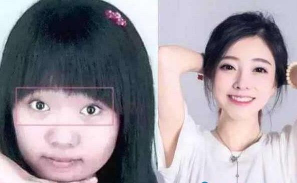 冯提莫告整形医院原因揭秘 高中素颜照曝光判若两人