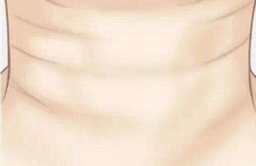 怎样淡化颈纹小妙招 颈纹消除按摩手法