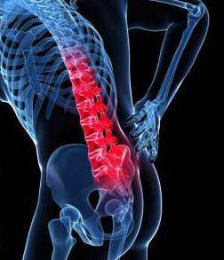 坐骨神经痛的症状.坐骨神经痛的锻炼方法