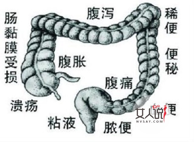 肠炎的这些你知道吗？一起来看一下吧。