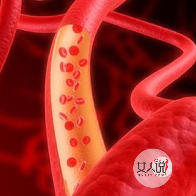 红细胞偏高?你还不知道是怎么了?快来看看有哪些原因吧