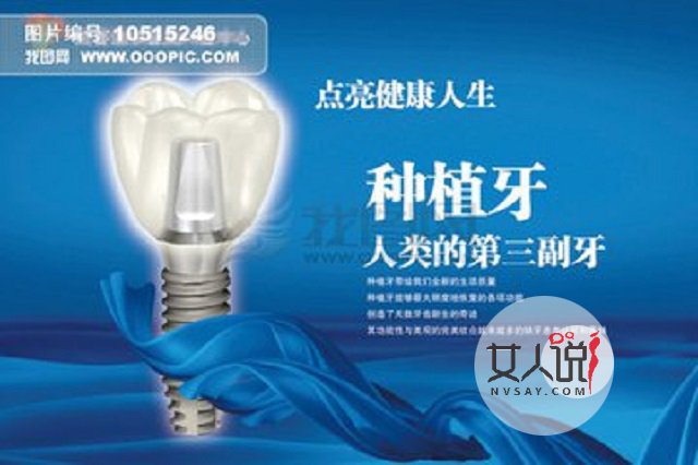 种植牙价格,种植牙有什么需要注意的事项,看这里就对了