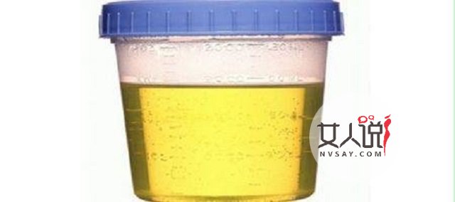 小便有泡沫?竟是你的身体可能出了哪些问题?不能忽视!!!