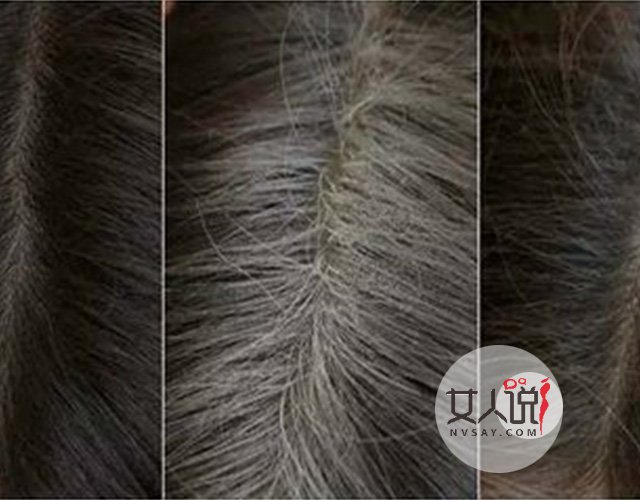 生活小妙招:白发变黑发的方法大盘点