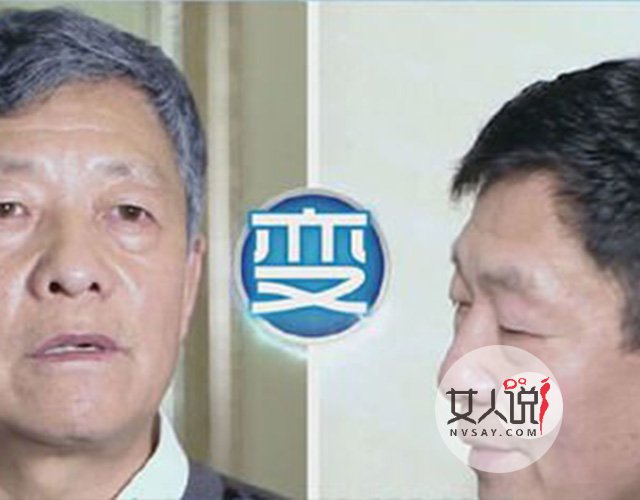 生活小妙招:白发变黑发的方法大盘点