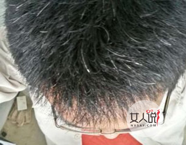 生活小妙招:白发变黑发的方法大盘点