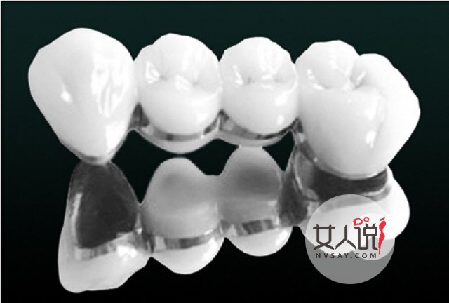 烤瓷牙价格表详细介绍,一口好牙笑出精彩人生!