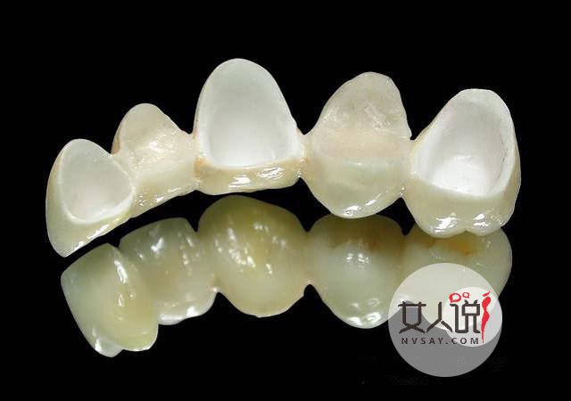 烤瓷牙价格表详细介绍,一口好牙笑出精彩人生!