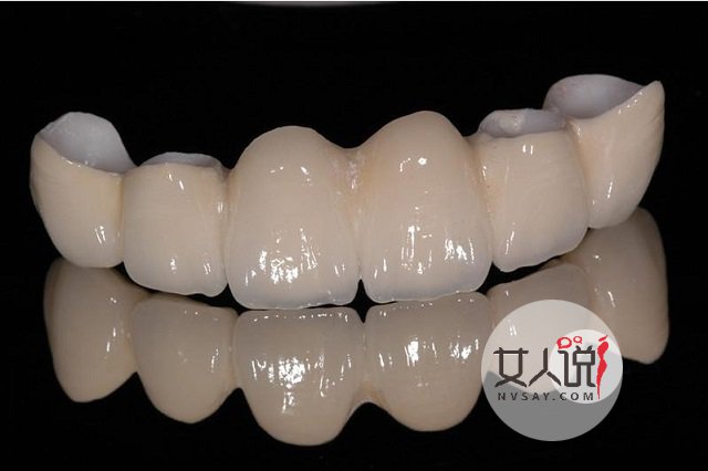 烤瓷牙价格表详细介绍,一口好牙笑出精彩人生!