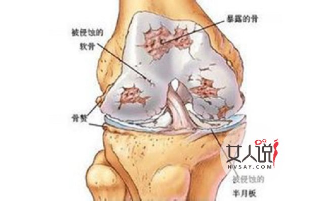 风湿病的症状,腿脚疼痛的同学“对号入座”啰!