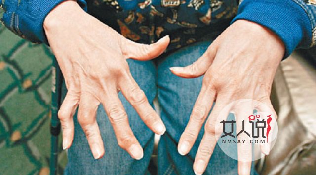 风湿病的症状,腿脚疼痛的同学“对号入座”啰!