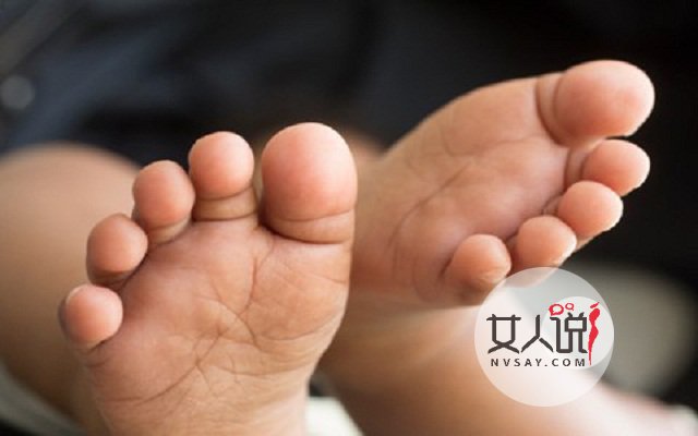 脚气怎么治?对症下药很关键!