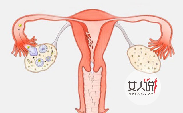多囊卵巢综合症不是事?你摊上大事了!