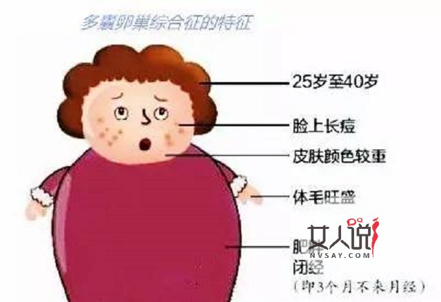 多囊卵巢综合症不是事?你摊上大事了!