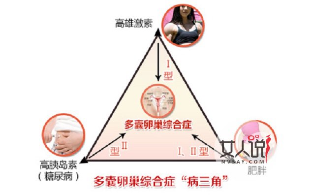 多囊卵巢综合症不是事?你摊上大事了!