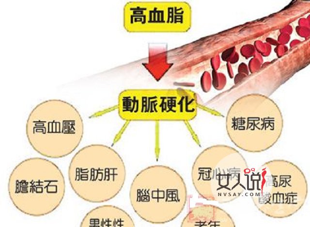血脂高的症状有哪些?你都知道吗?