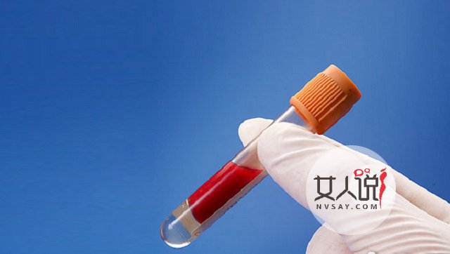 血脂高的症状有哪些?你都知道吗?